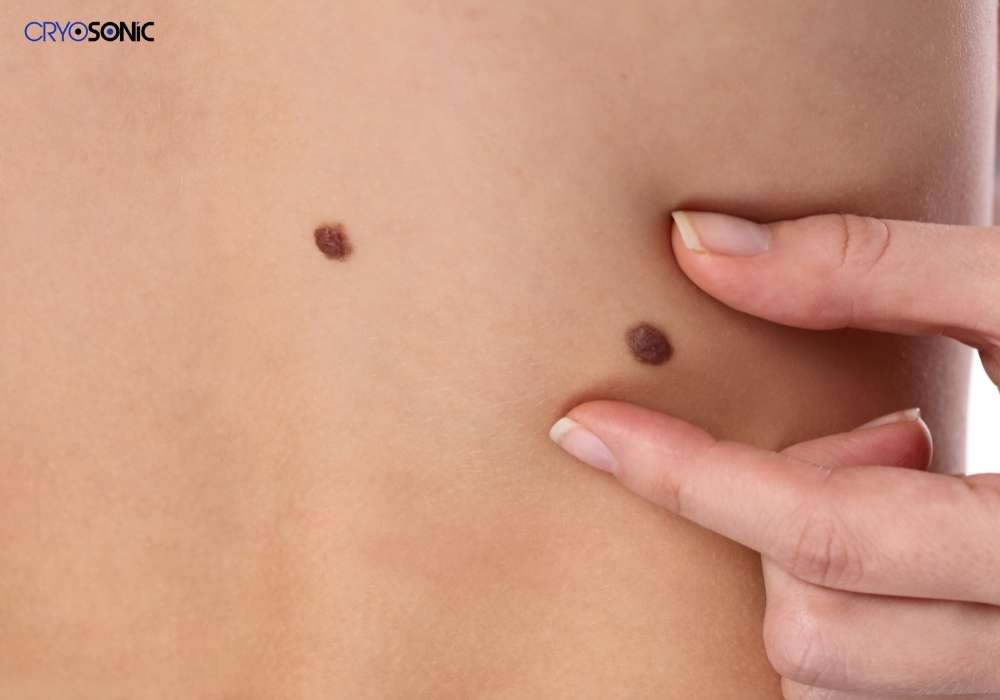Infection Risk and Poor Aftercare Basildon